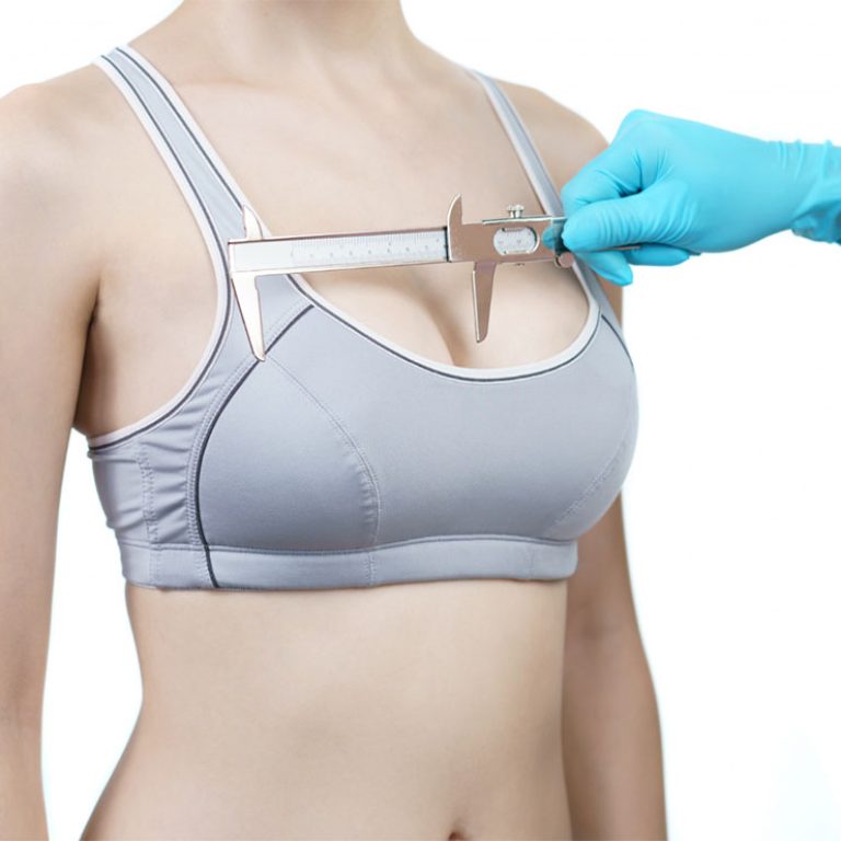 1 breast augmentation