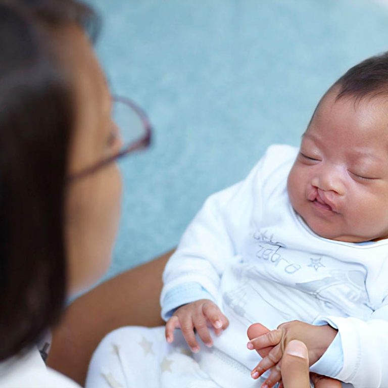 Cleft Lip and Palate Repair1