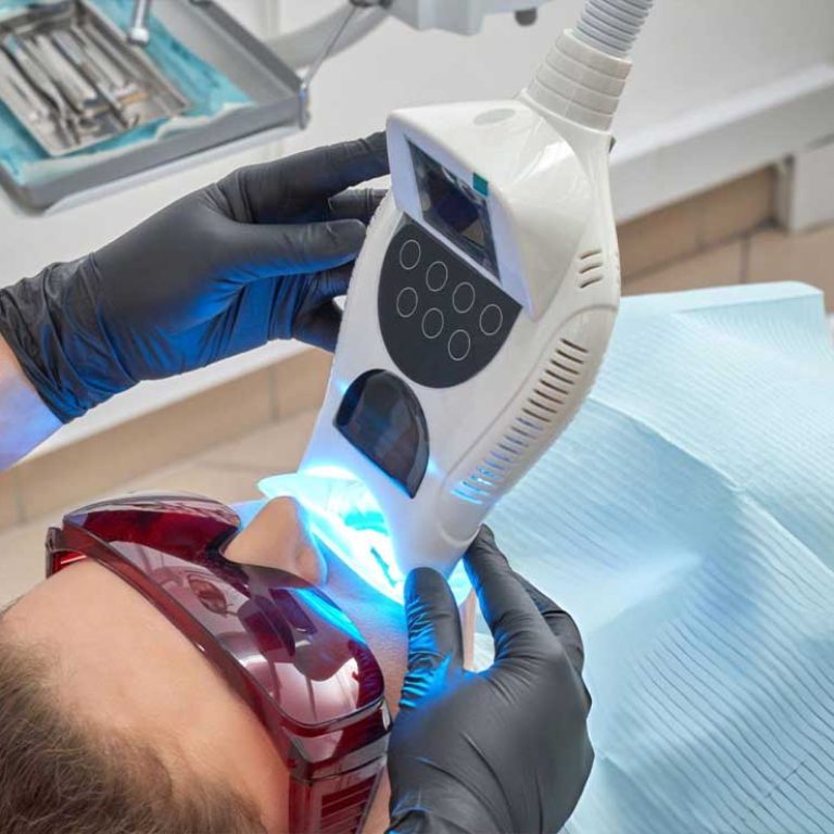 Laser teeth whitening1