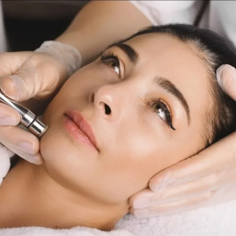 Microdermabrasion