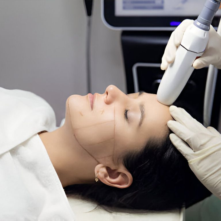 Non-Surgical Facelift1