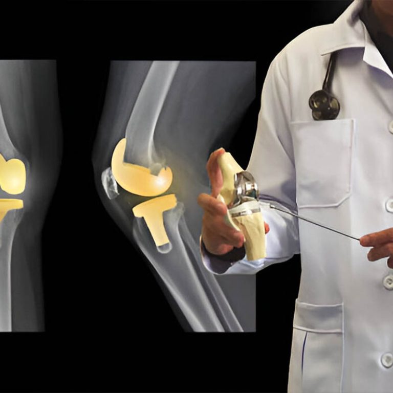 Orthopedic Procedures and Joint Replacement1