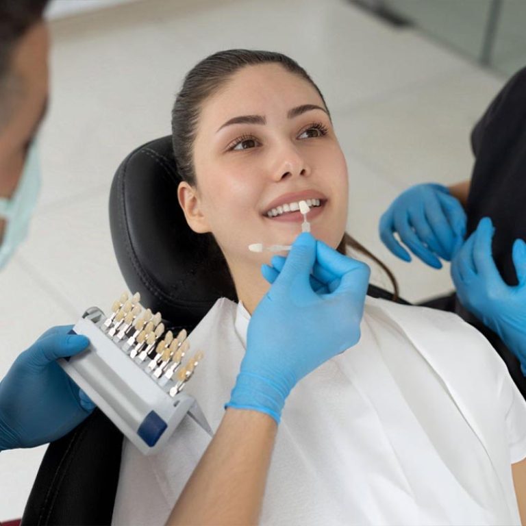 Smile enhancement with veneers1